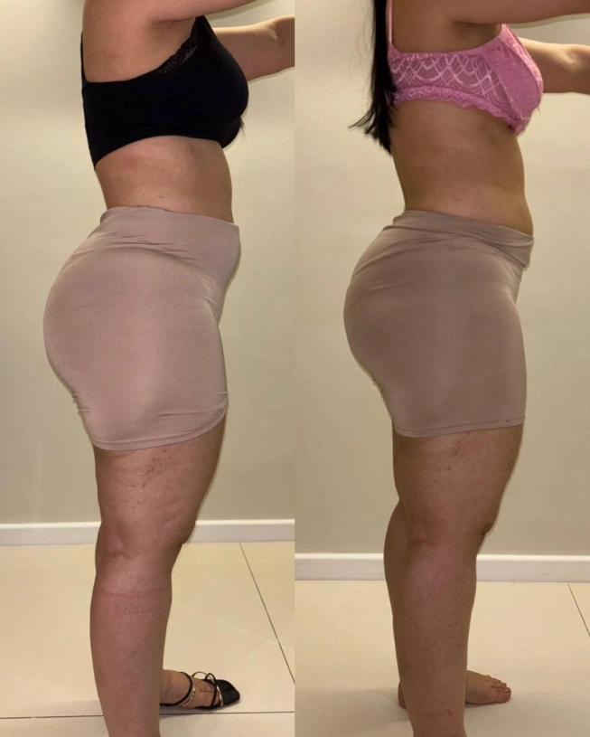 Antes e depois 1