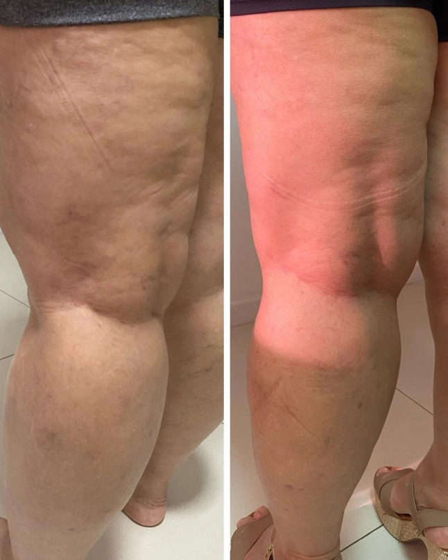 Antes e depois 2