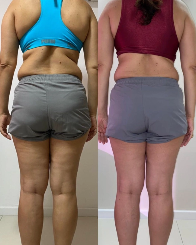 Antes e depois 3